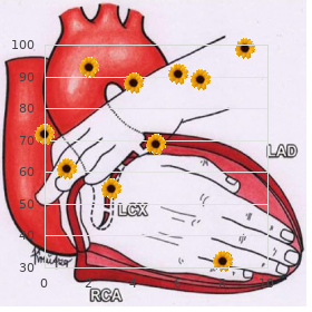 Familial cold autoinflamatory syndrome (FCAS)