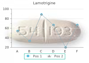 lamotrigine 100 mg mastercard