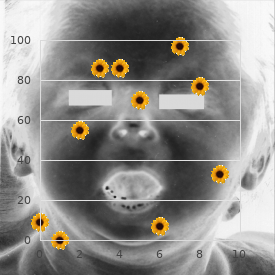 Amaurosis hypertrichosis