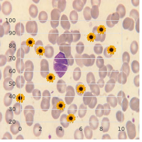 Gaucher disease type 2