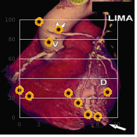 Lowe Kohn Cohen syndrome