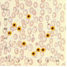 Caroli disease