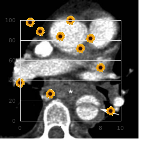 Annuloaortic ectasia