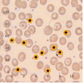 Glioma