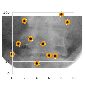 Choreoathetosis familial paroxysmal