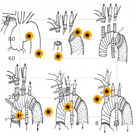 Glycogen storage disease type 9