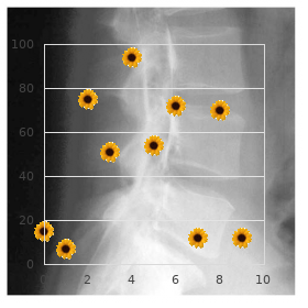 Osteopathia striata cranial sclerosis