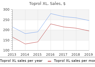 discount toprol xl 100 mg on line