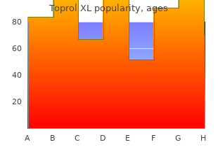 buy toprol xl 100mg with amex