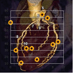 Kikuchi disease