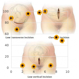 Wiedemann-Rautenstrauch syndrome