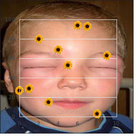 Nonallergic atopic dermatitis