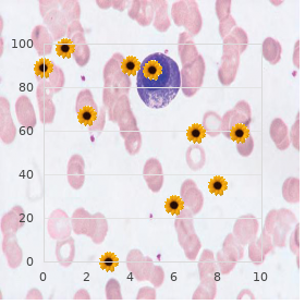 Gingival fibrosis