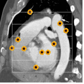 Polycystic kidney disease, infantile type