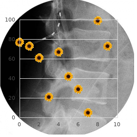 Laterality defects dominant