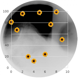 Optic atrophy