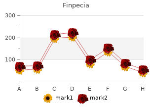 order finpecia 1 mg