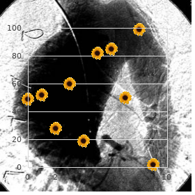 Endomyocardial fibroelastosis